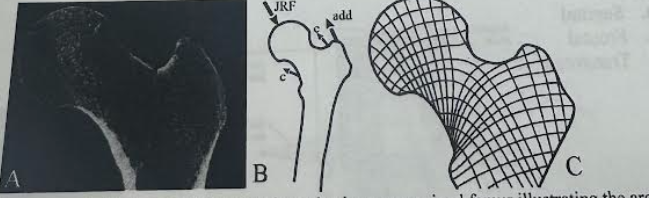 <p>What current concept of bone mechanobiology is illustrated by the diagram below? Ignore what might appear to be a fracture in panel A</p><p>(A) is a coronal micro-computed tomographic section through a human proximal femur illustrating the architecture of cancellous bone. (B) is a typical loading regime experienced by the proximal femur during locomotion. (C) displays principal stress trajectories resulting from the loading regime in B.</p><p>a. An equilibrium range (“dead zone”) of strains exists in which no adaptive response is elicited</p><p>b. Trabeculae align with (continuum) principal stress directions </p><p>c. Disuse increases endosteal bone resorption and intracortical porosity in the mature skeleton</p><p>d. Dynamic loading elicits a response but static loading does not</p>