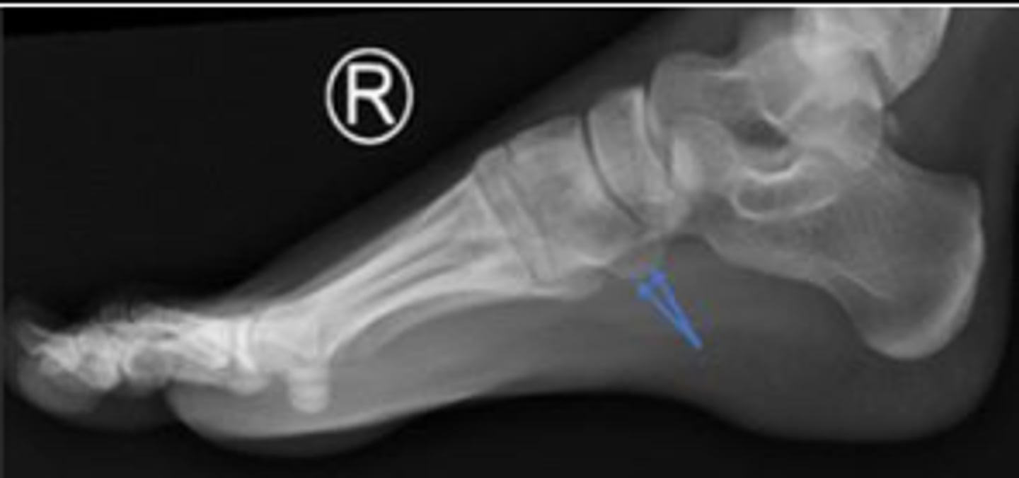 <p>What are the arrows pointing to?</p>