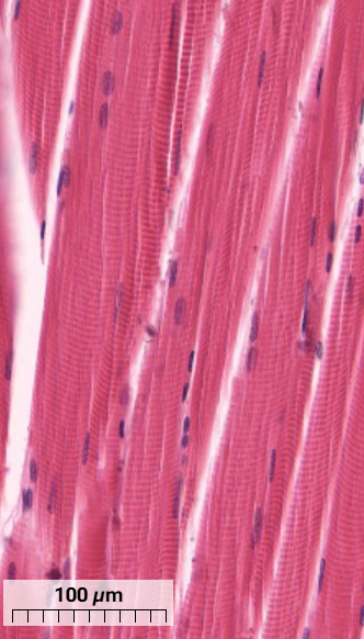 <p>What muscle cell is this and how can you tell? (Longitudinal section)</p>