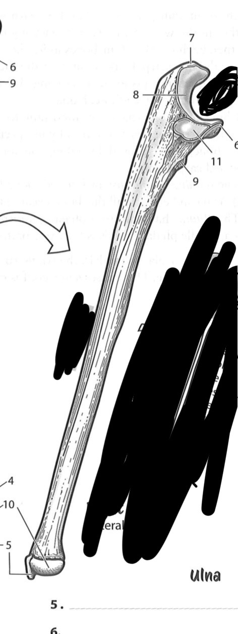 <p>11</p>