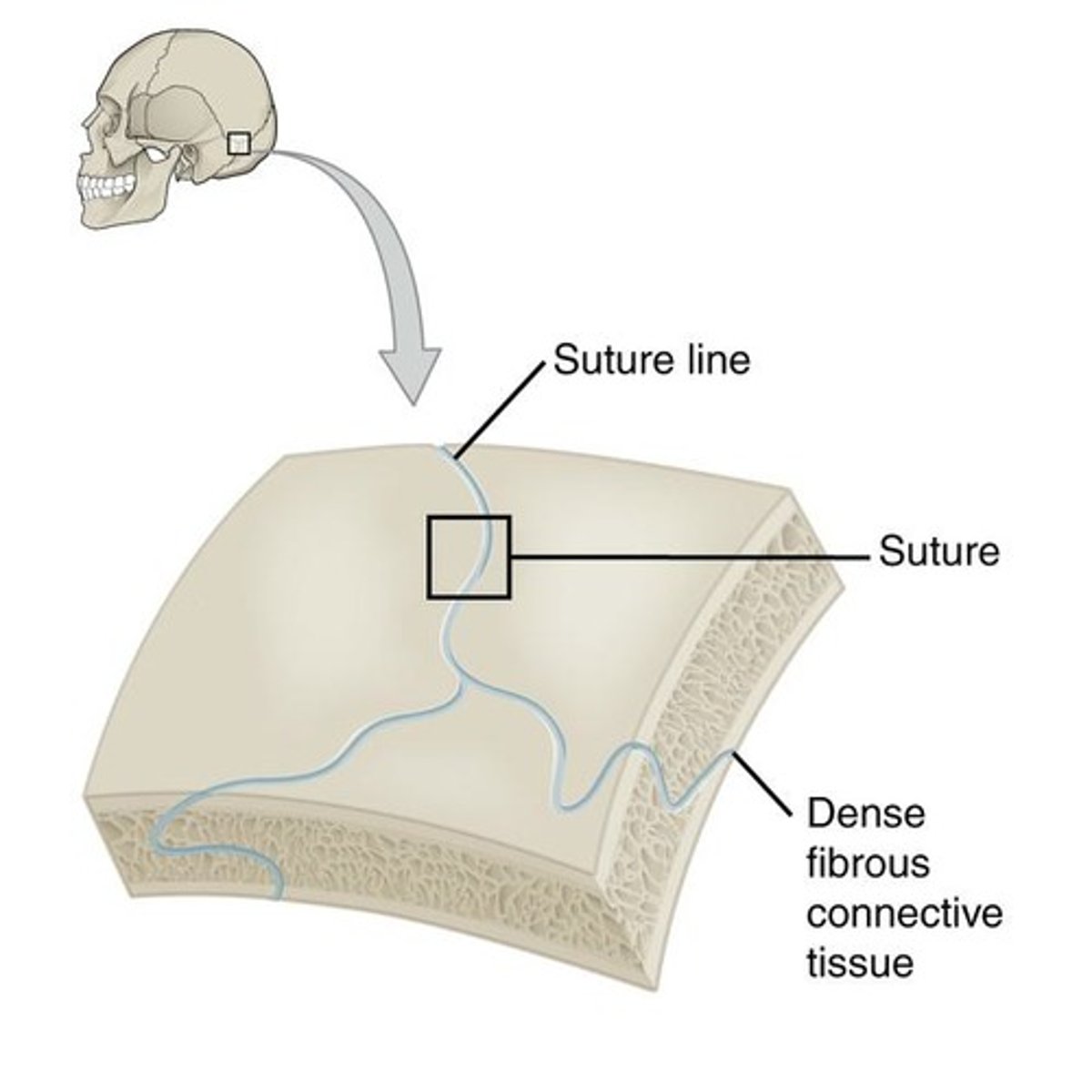 <p>Suture.</p>