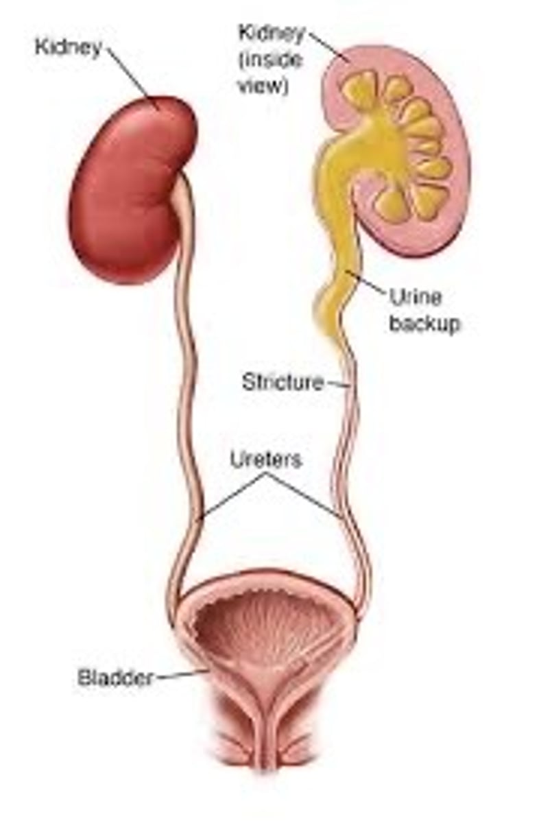 <p>Tubes that connect kidneys to the bladder</p>