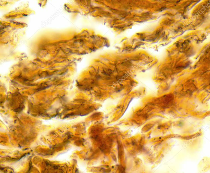 <p><span style="font-family: Times New Roman, serif"><em>Treponema pallidum</em></span></p><p><span style="font-family: Times New Roman, serif">Helical (spiral-shaped), tightly coiled which is typical of spirochetes</span></p><p>Single cells </p><p>Pink (Gram negative)</p><ul><li><p>pathogen (does not survive well outside the human body), causative agent of Syphilis</p></li></ul><p></p>