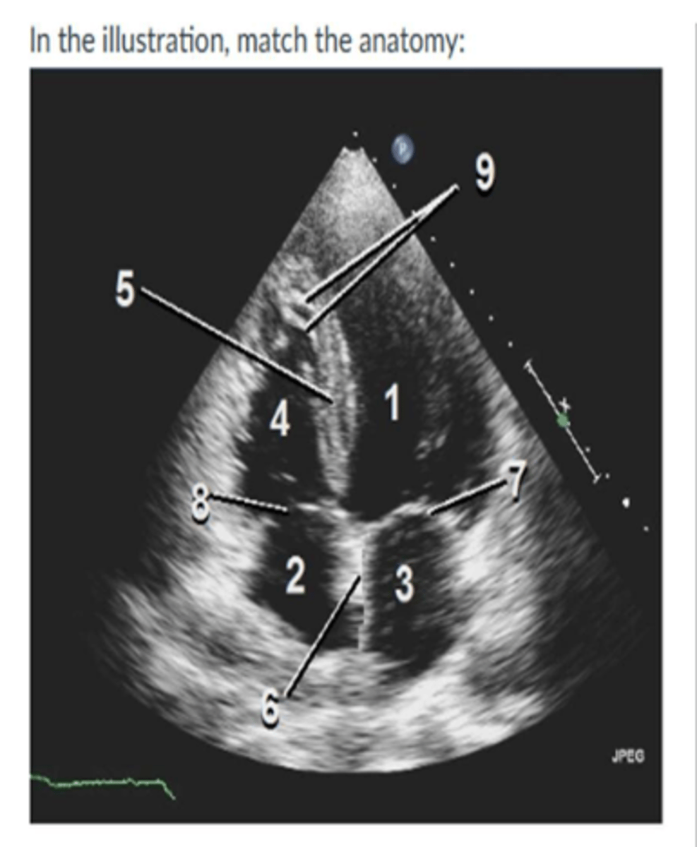 <p>1. left ventricle</p><p>2. right atrium</p><p>3. left atrium</p><p>4. right ventricle</p><p>5. IVS</p><p>6. IAS</p><p>7. MV</p><p>8.TV</p><p>9. Moderator Band</p>