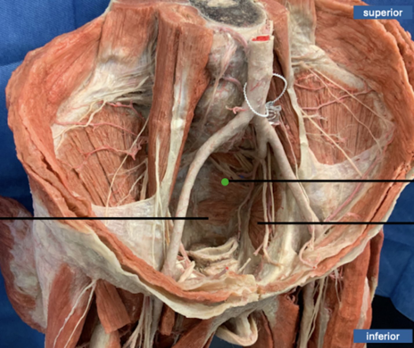 <p>muscle</p>