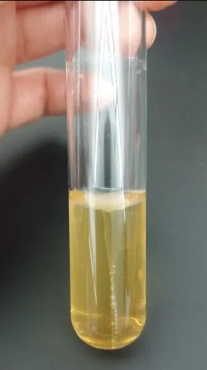 <p>Solid</p><p><strong>Explanation:</strong> This bacteria produces gelatinase, which can break down collagen and tissues in a clinical setting.</p>