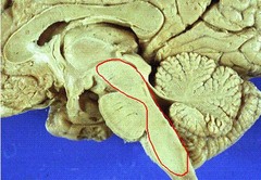 <p>motor region of the midbrain; contains dopaminergic neurons</p>