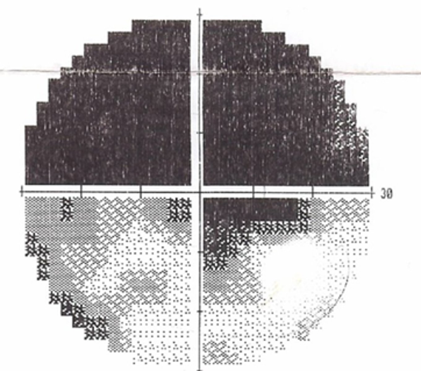 <p>What main things will we see during our exam in <strong>GCA</strong>?</p>