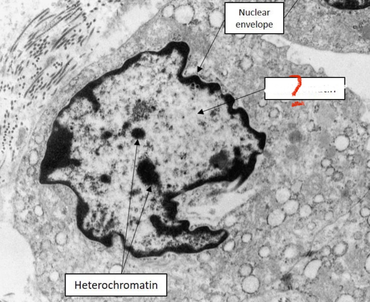 <p>What part of the nucleus is indicated?</p>