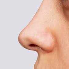 <p>The structure that humidifies and filters the air entering the respiratory tract is the <strong><em><em></em></strong></em>__.</p>