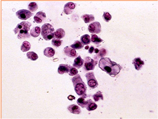 <p>These cells are present on sediment evaluation. What are they?</p>