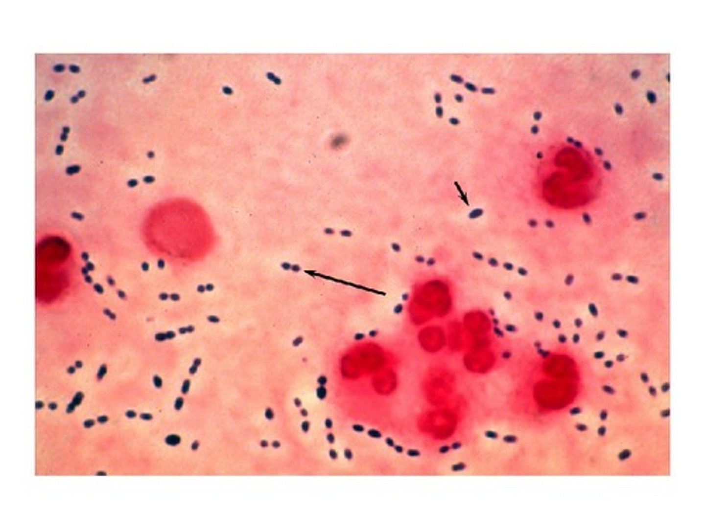 <p>- +ve lancet-shaped cocci</p><p>- facultative anaerobe</p><p>- causes CAP; also ass w/ meningitis &amp; otitis media</p><p>- virulence factors: polysaccharide capsule, pneumolysin</p><p>- alpha-hemolysis on blood agar (green discoloration)</p><p>- +ve bile solubility test</p>