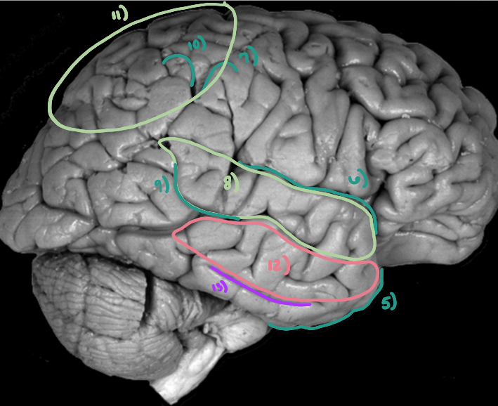 <p>What is number 13 in this?</p>