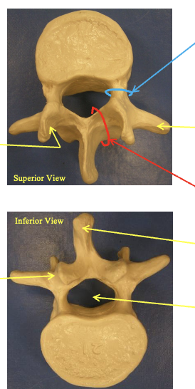 <p>Lumbar vertabrae (what are its components and how do you identify it from the rest </p>
