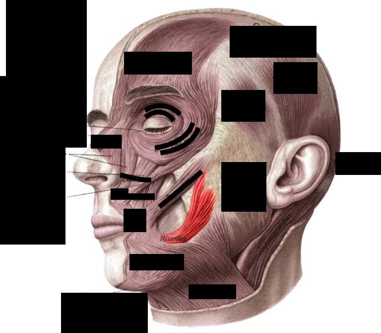 <p>What muscle is this? (check highlighted area) </p>