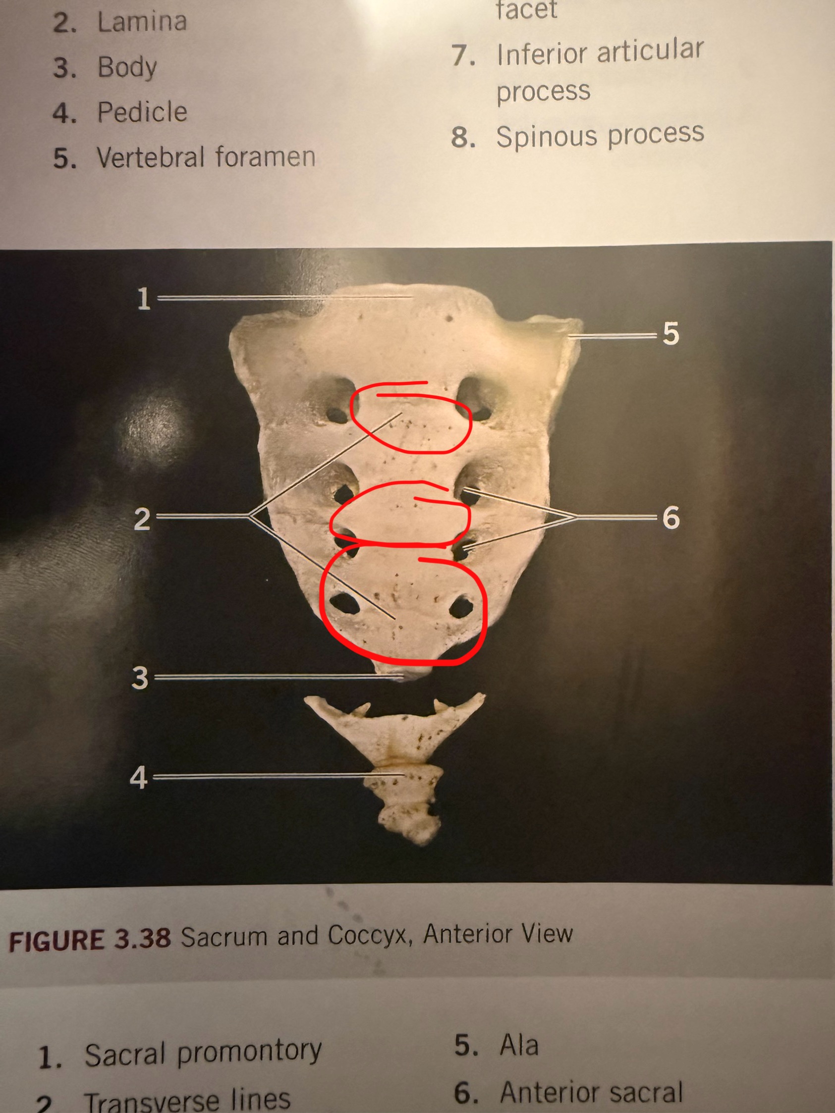 term image