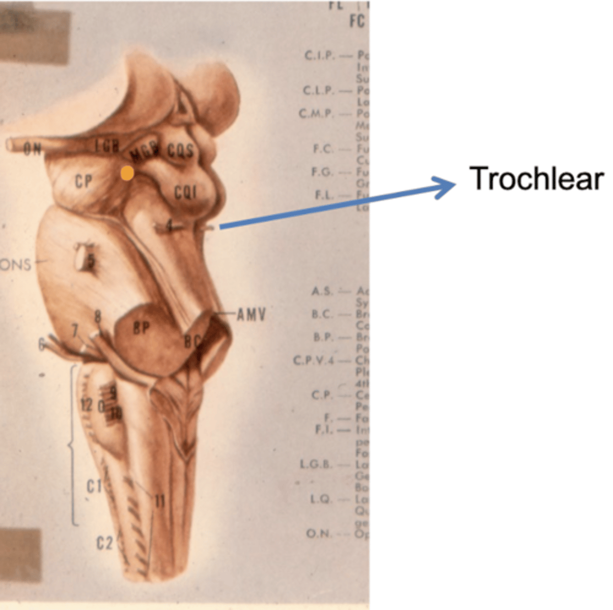 <p>acceleration/deceleration</p><p>why? -- location nerve exits the brain makes it susceptible to being crushed by posterior structure</p>