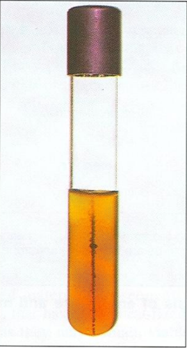 <ol><li><p><em><u>Erysipelas rhusiopathiae</u></em></p></li><li><p>Triple Sugar Iron</p></li><li><p>H<sub>2</sub>S (Hydrogen Sulfide) </p></li></ol><p></p>