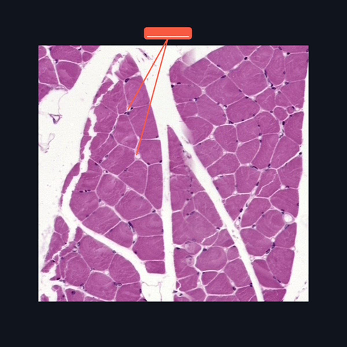 <p>Identify the structure</p>