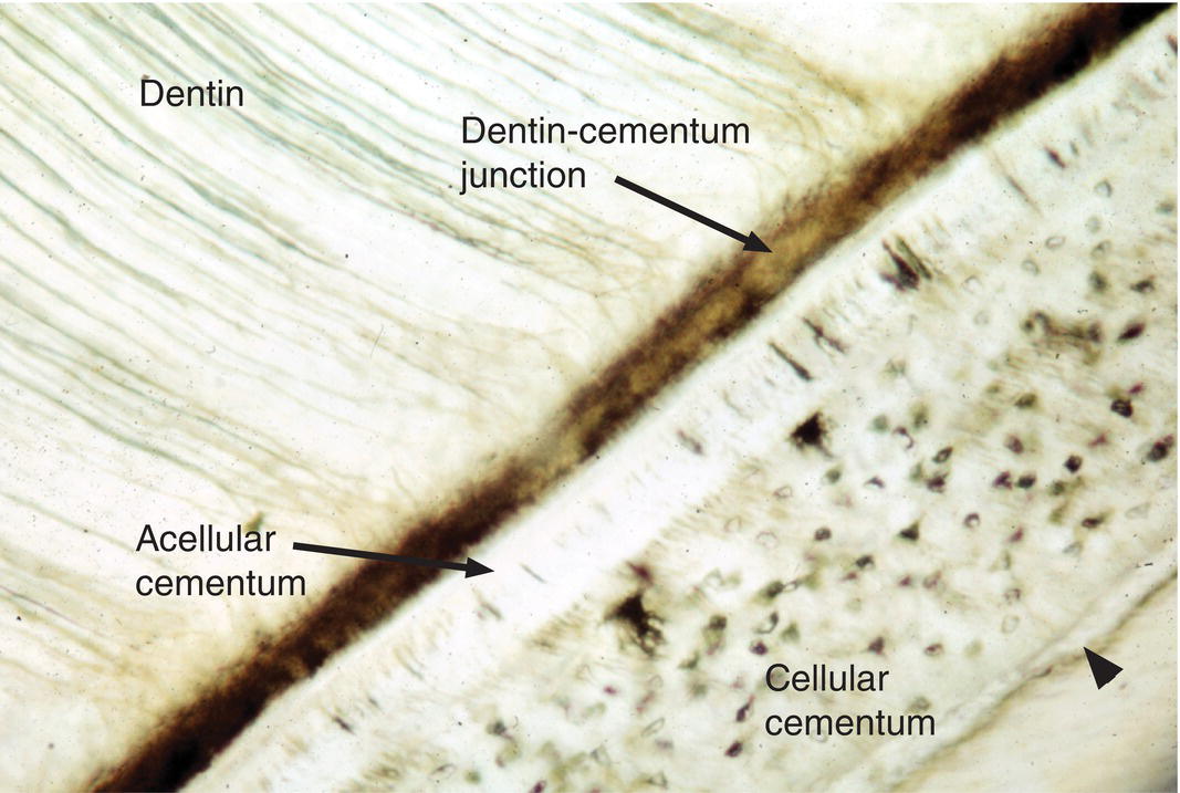 <p><span>a thin layer of mineralized tissue that covers the cervical (upper) part of the tooth root and does not contain cells</span></p>