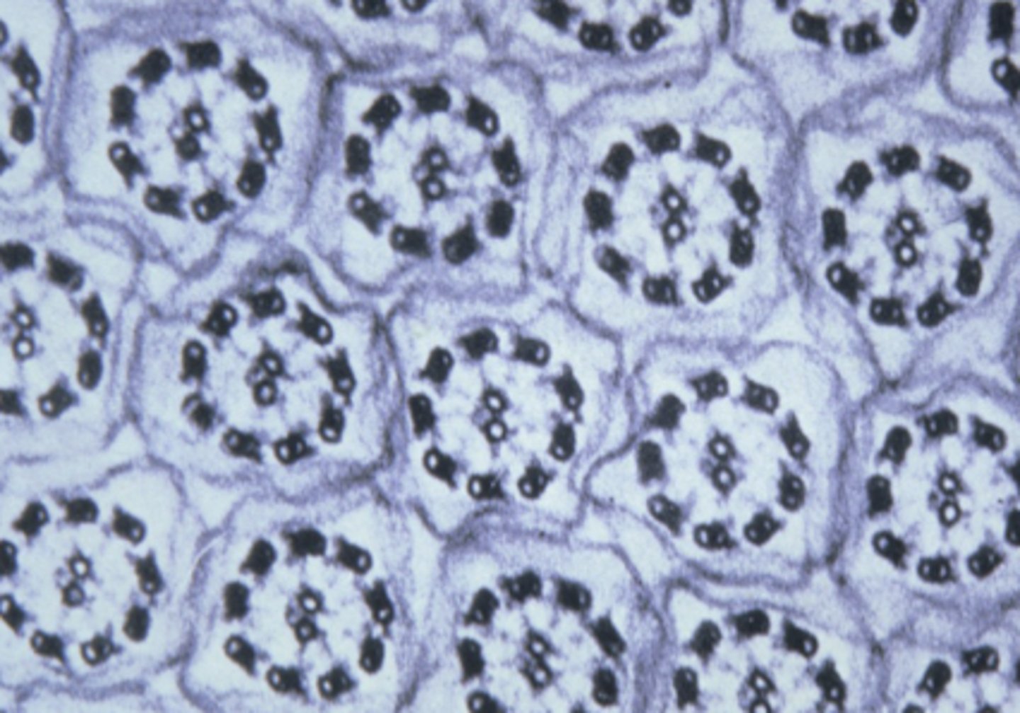 <p>what cell structure is shown</p>