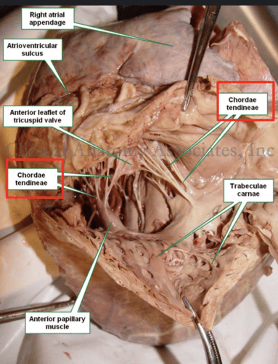 <p>During ventricular systole (contraction), the tricuspid valve closes </p><p>The papillary muscles contract at the same time as the ventricle.</p><p>This contraction tightens the chordae tendineae, pulling the valve leaflets taut and holding them in place.</p><p>This mechanism prevents the valve leaflets from prolapsing (bulging back) into the atrium under the high pressure of ventricular contraction.</p>