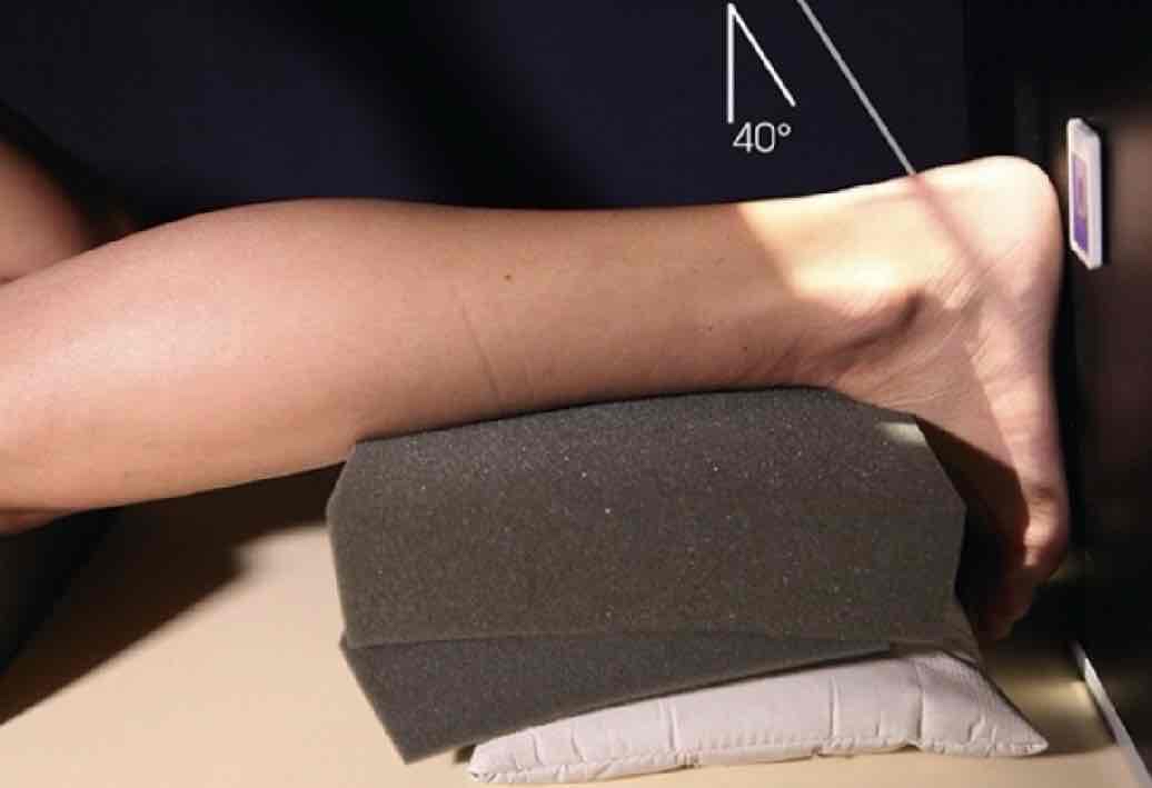 <p>What Projection is this?</p>