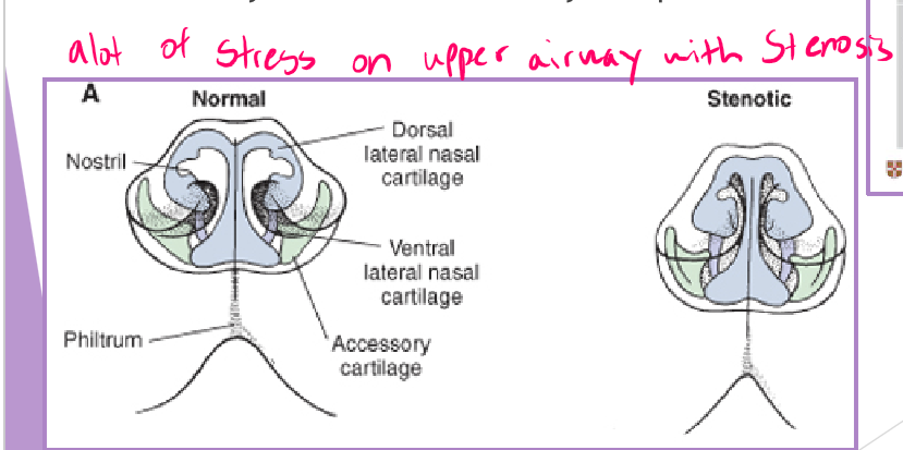 <ul><li><p>abnormally narrow nostrils </p><ul><li><p>congenital malformation of nasal cartilages </p></li></ul></li><li><p>why a concern </p><ul><li><p><strong>normal </strong>resistance to airflow is 76-80%</p></li><li><p>airway pressures increase with narrowing </p></li><li><p>airway tissues will eventually collapse </p></li></ul></li><li><p>surgical management - open the nares </p><ul><li><p>multiple techniques </p><ul><li><p>cartilage resection / suture anastomosis </p></li><li><p>cartilage amputation (traders technique) </p></li></ul></li></ul></li></ul><p></p>