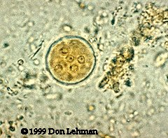 <p>in human stool</p><p>no symptoms</p><p>worldwide</p>