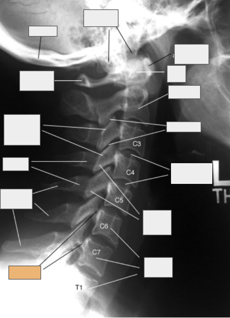 <p>What structure of the spine does the box highlighted in orange reference to?</p>