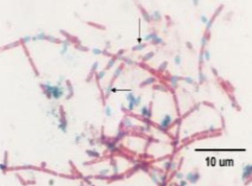 <p>What type of stain is this</p>