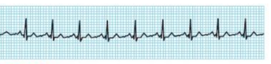 <p>What does this trace show ? </p>