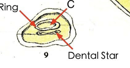 <p>Corresponds with pulp cavity, appears as line and then oval as horse ages</p>