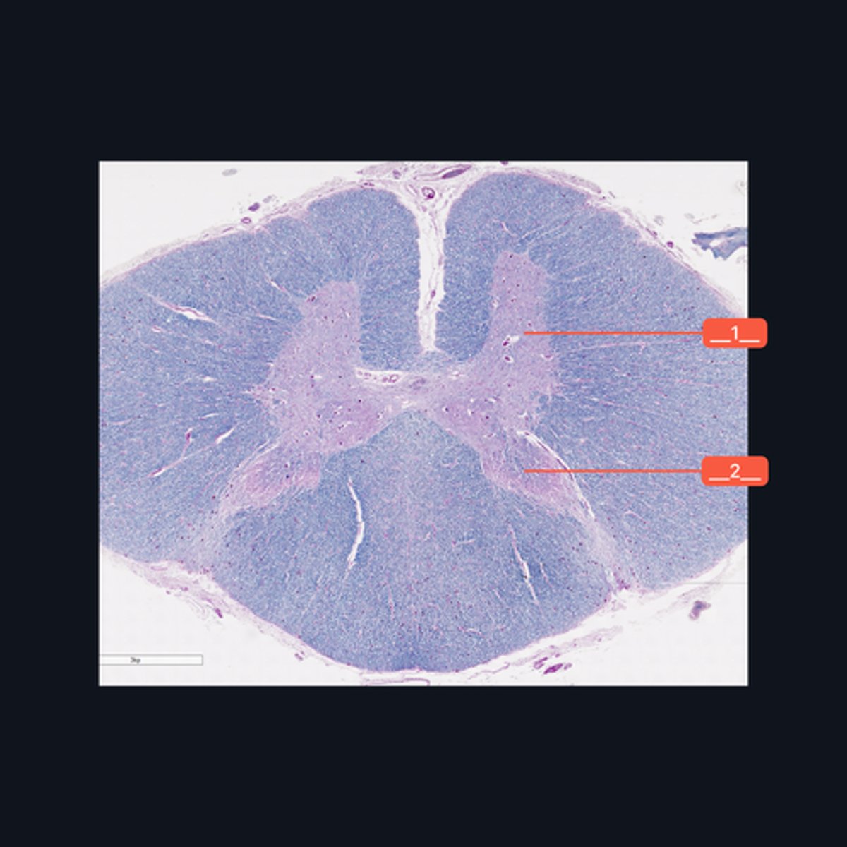 <p>Identify the pointed regions of the gray matter of the spinal cord</p>