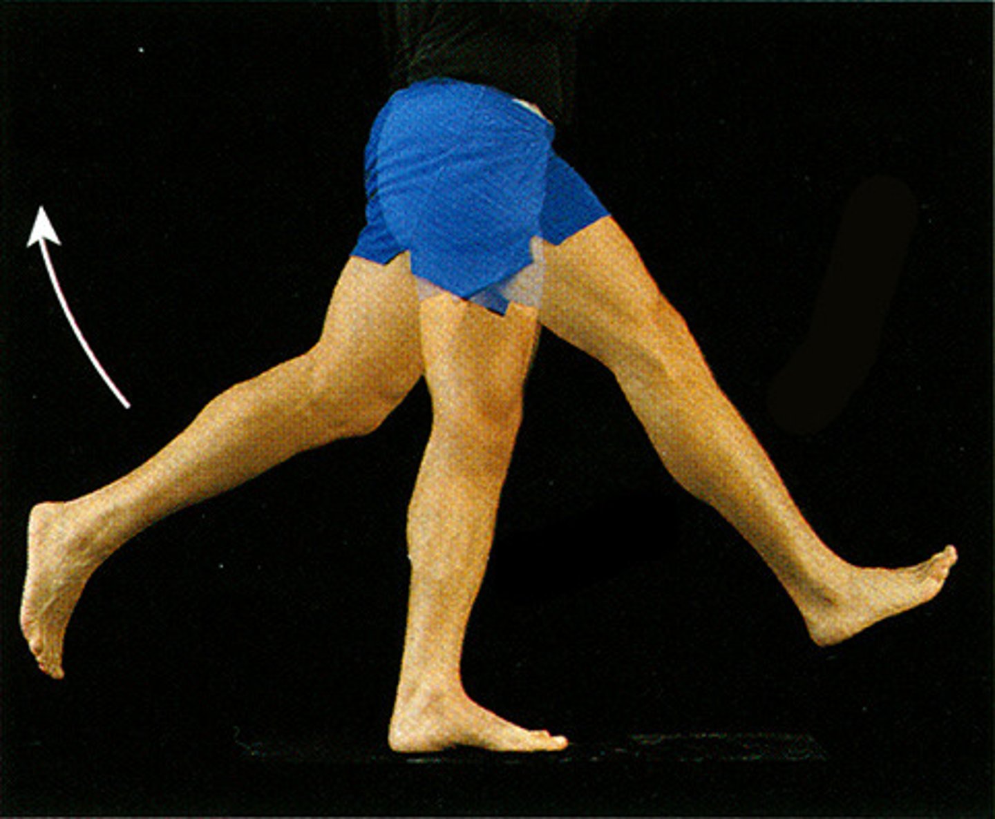 <p>Extension beyond anatomical position.</p>