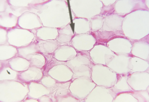 <p>what kind of tissue is this </p>