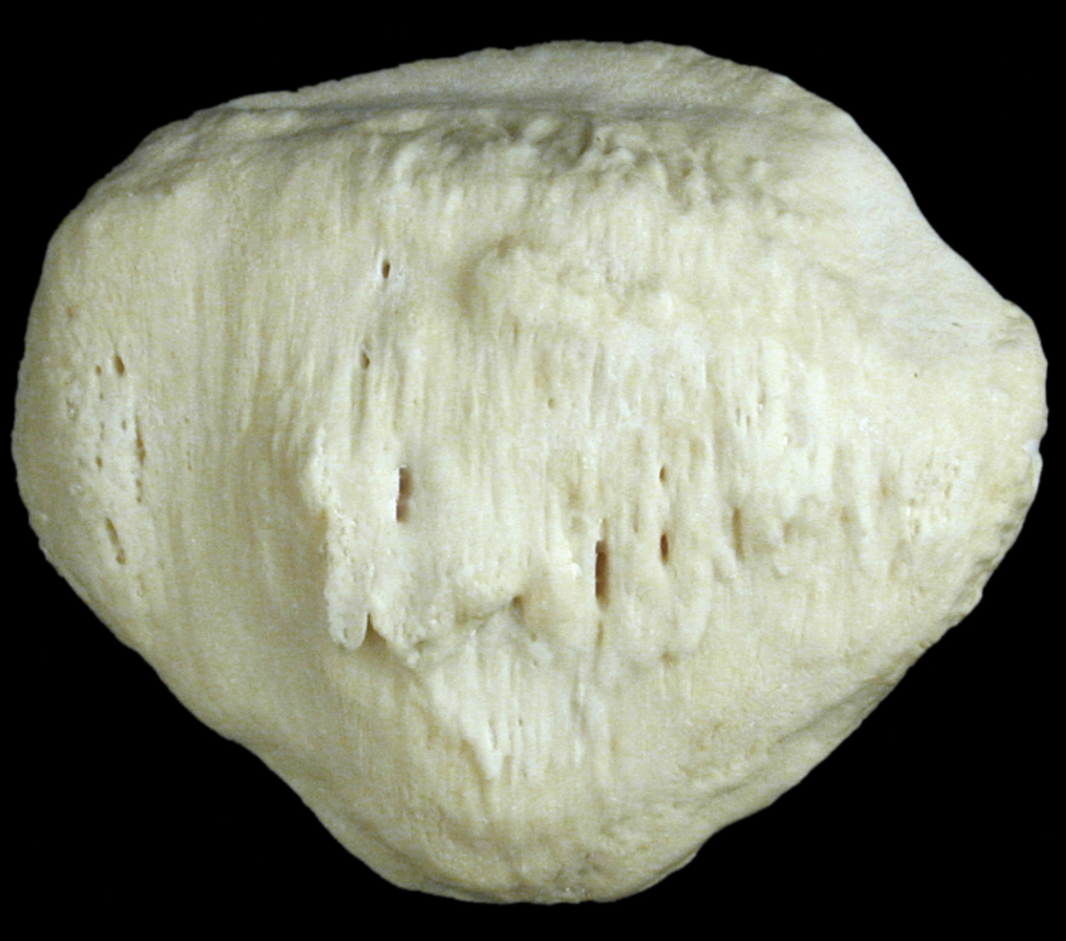 <p>smooth flat side of patella </p>