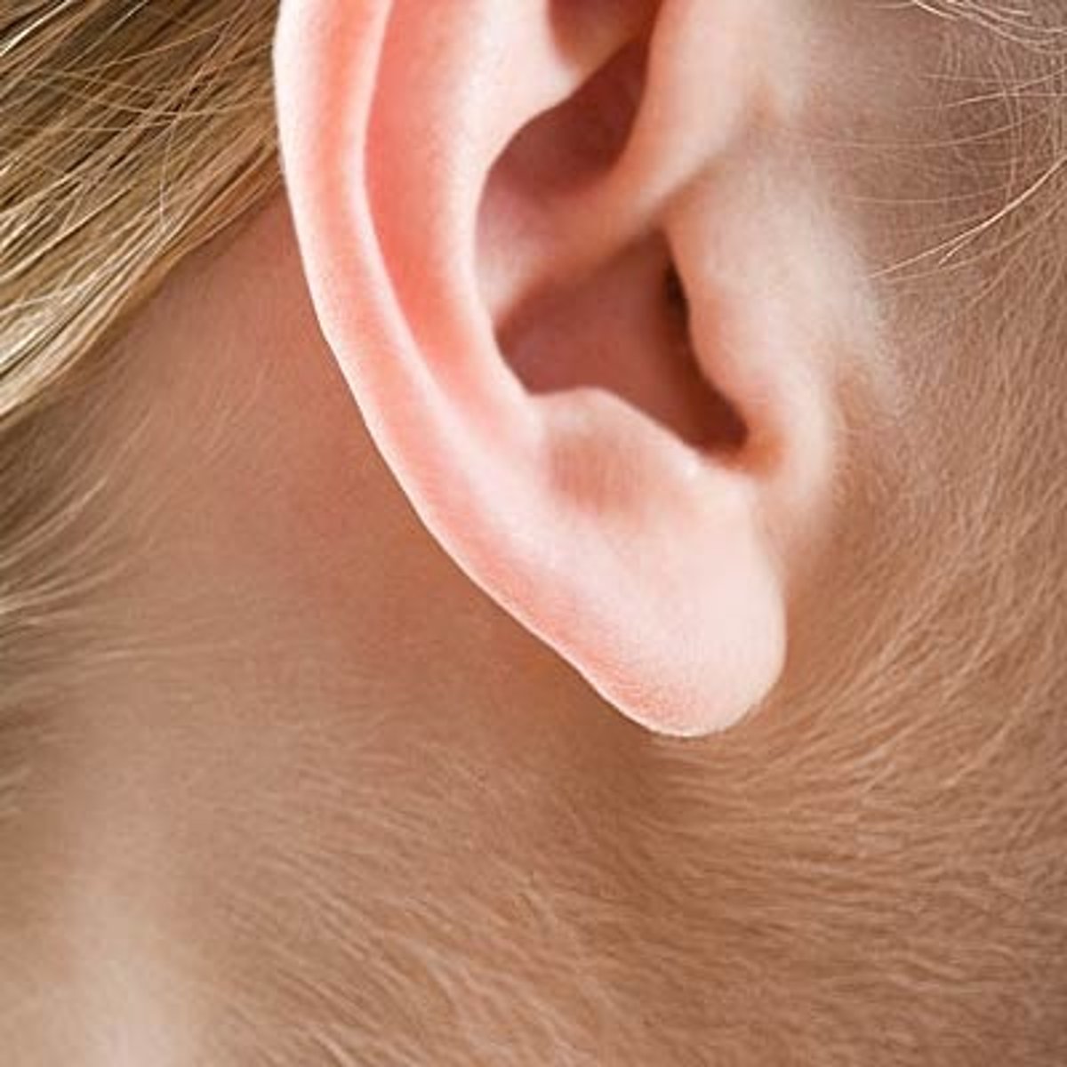 <p>Similar to lanugo but found on adults, "peach fuzz"</p>