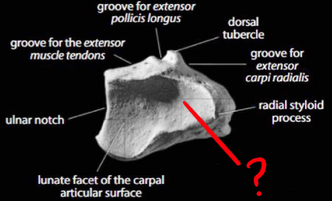 term image