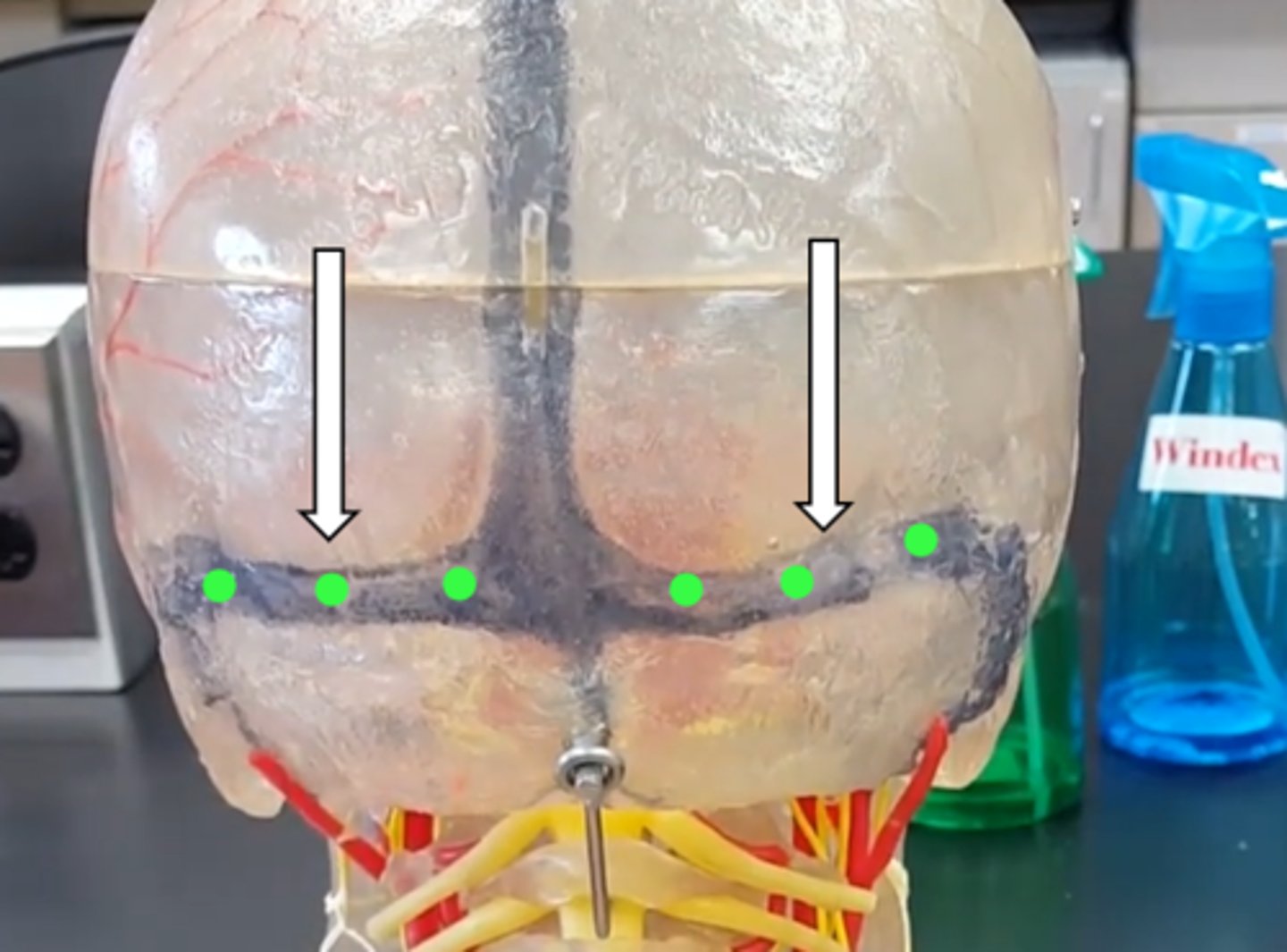 <p>name the structure</p>
