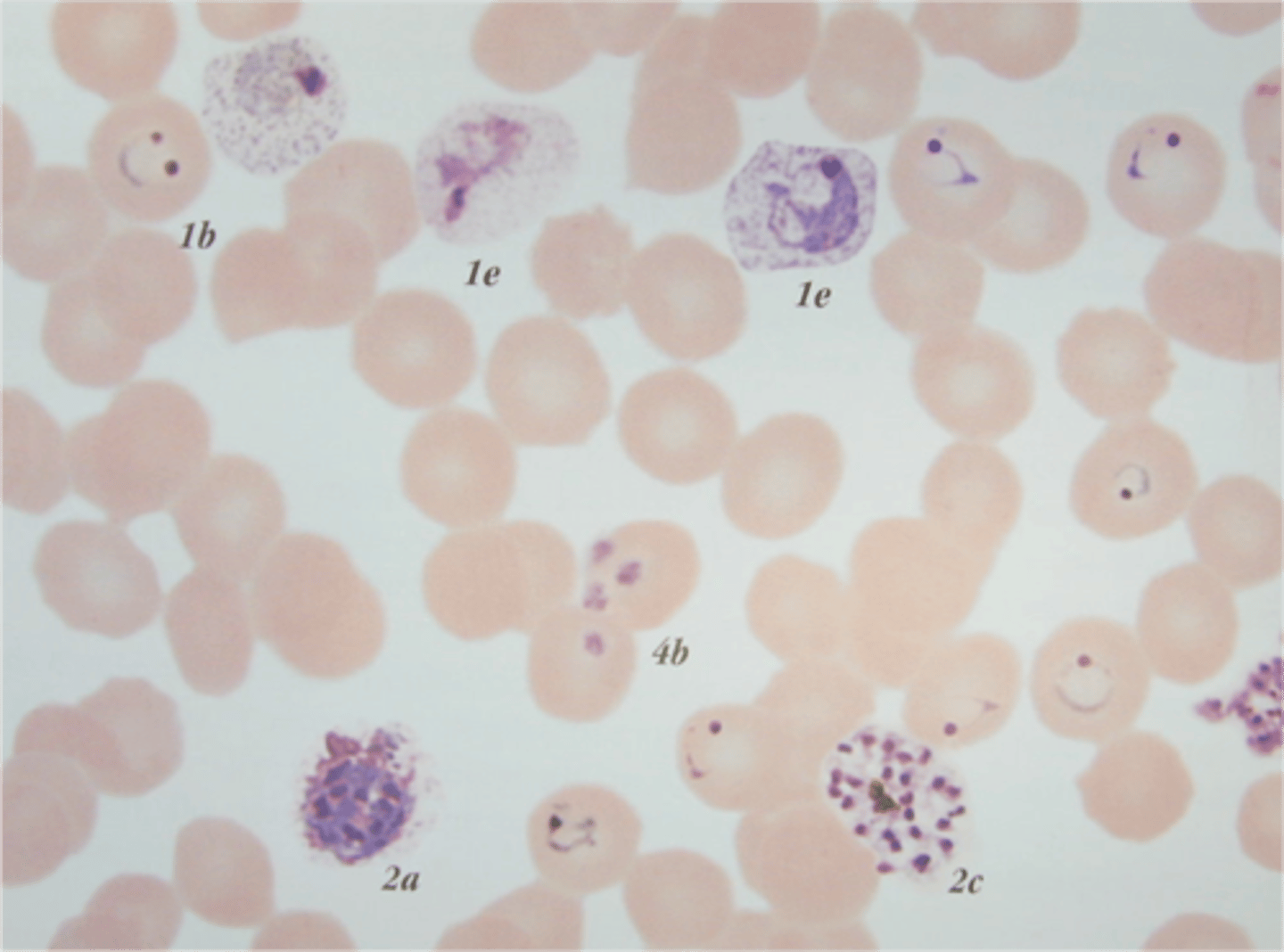 <p>What is this Protozoa</p>