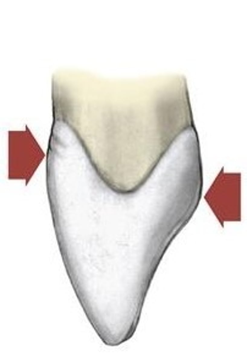<p>The labial height of the contour is in the cervical third</p>
