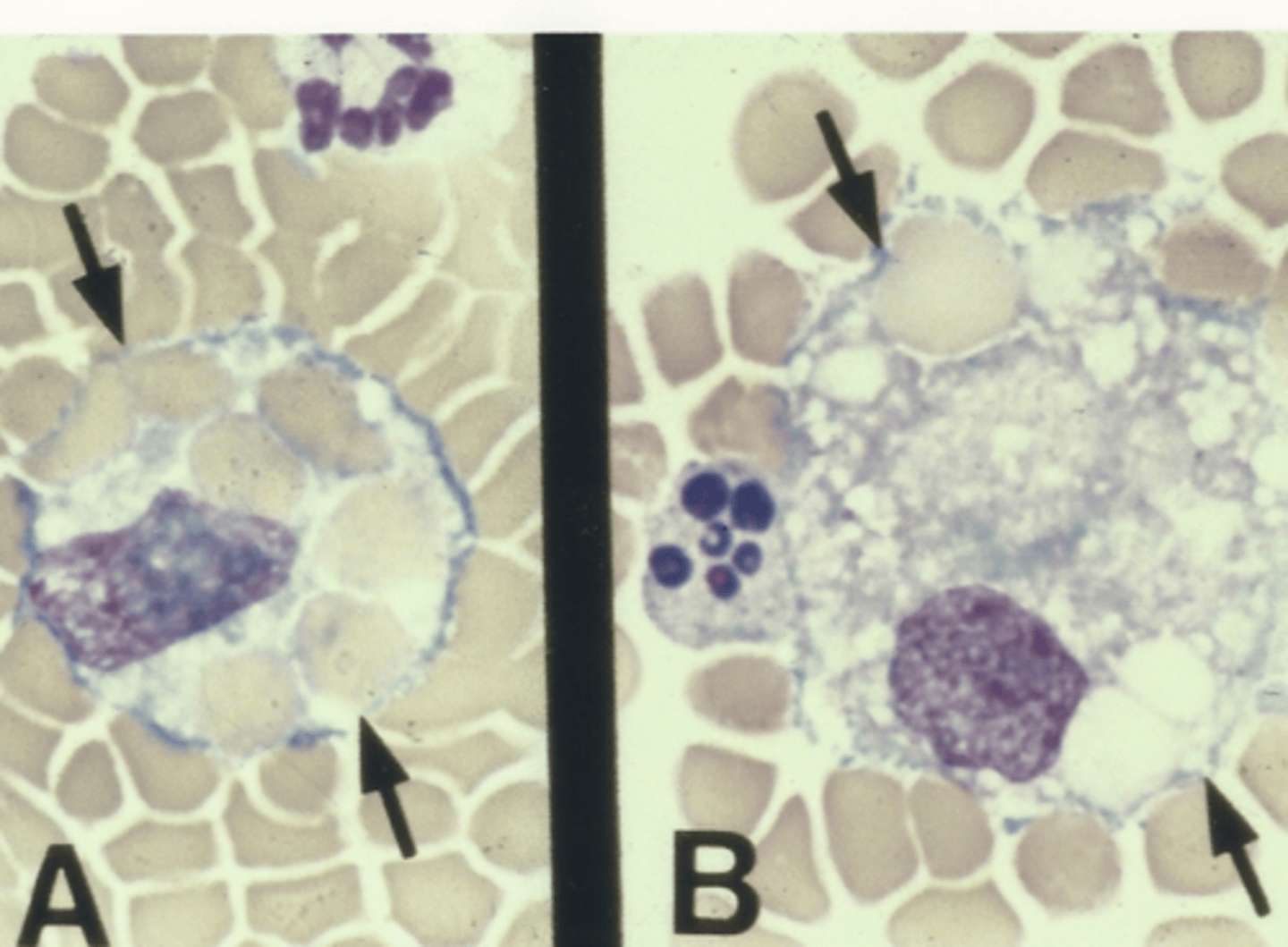 <p>Identify the cells in this body fluid</p>