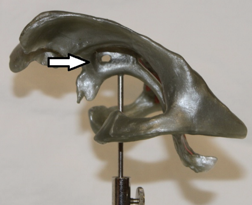 <p>identify this structure/opening</p>