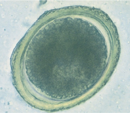 <p>Tito, a 2 month old puppy, presents to the clinic with a pot bellied appearance and the owner states the puppy has worms that are round on both ends and bilateral symmetrical in his feces. Upon fecal floatation, you find this egg under the microscope. What parasite is this?</p>