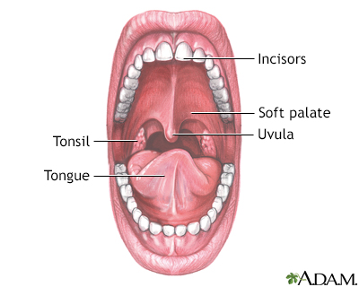 <p>uvula, palate<br>eg. staphyloderma</p>