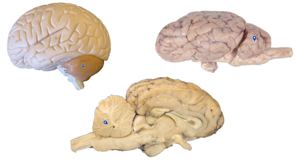 <p>What region is the arrow pointing to?</p>