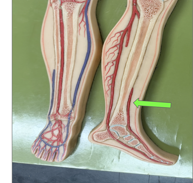 <p>What artery is this </p>