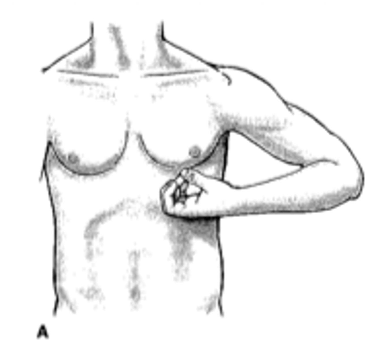 <p>Scap retraction/elevation• Shoulder abd, ER</p><p>Elbow flexion</p><p>Forearm supination</p><p>Wrist & finger flexion</p>