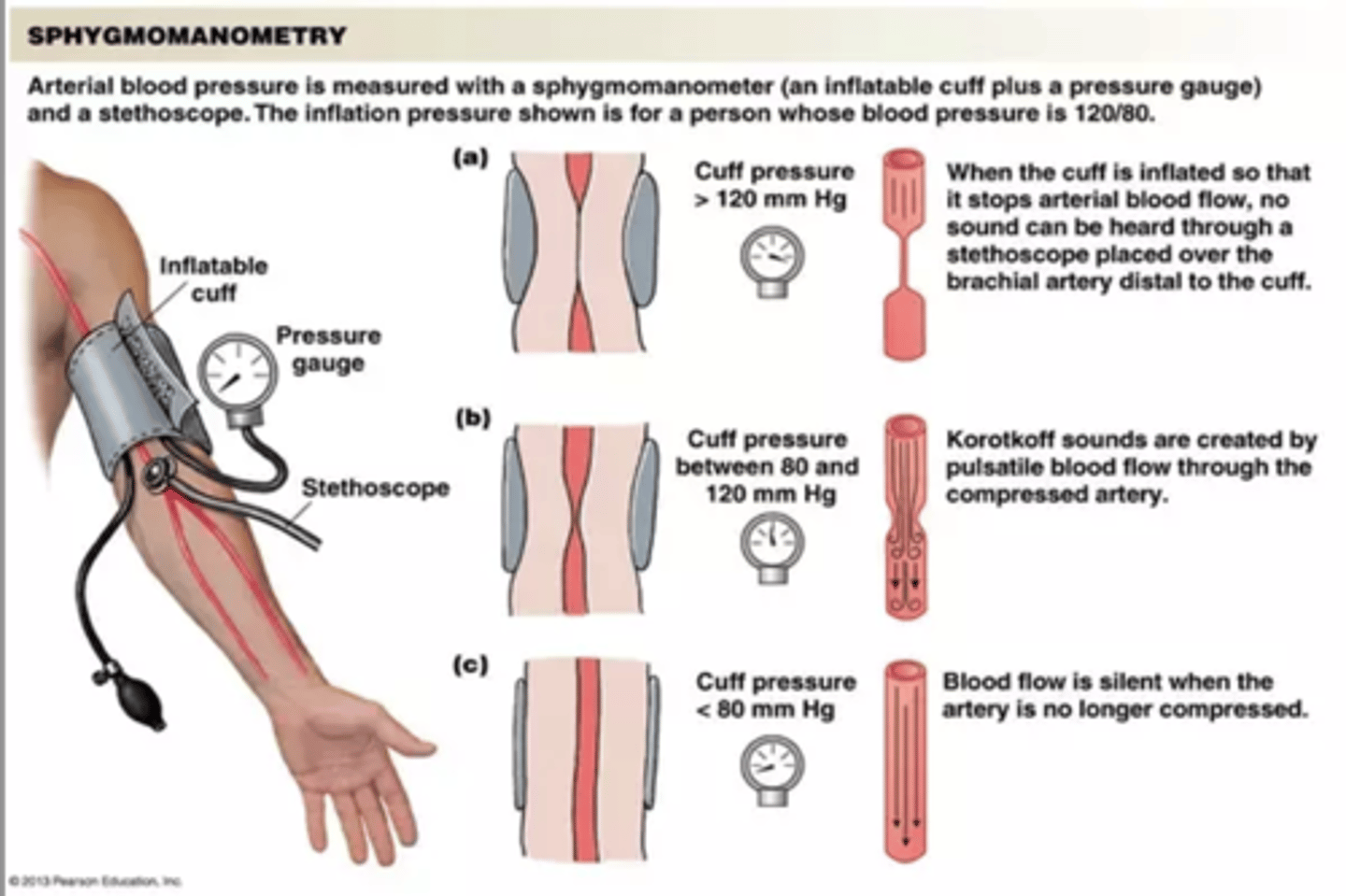 <p>- intro and consent</p><p>- wash hands</p><p>- position patient and adequately expose and support the arm</p><p>- demonstrate appropriate choice of size cuff and apply firmly to subjects upper arm (make sure artery lines up with line and tube on cuff)</p><p>- locate and palpate either brachial or radial pulse and use to estimate systolic pressure by: inflate cuff till cannot feel radial pulse anymore</p><p>- release cuff</p><p>- place stethoscope over brachial artery and inflate cuff to above estimated systolic pressure</p><p>- deflate cuff slowly: systolic pressure is when you hear Korotkoff sounds start and diastolic is when the Korotkoff sounds stop</p><p>- fully deflate cuff</p><p>- remove cuff</p><p>- thank patient and cover or ask to redress</p><p>normal bp range is 120/80 - 90/60</p>